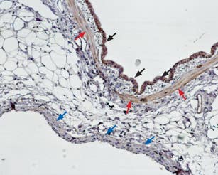 Anti-Endothelin Receptor B Antibody