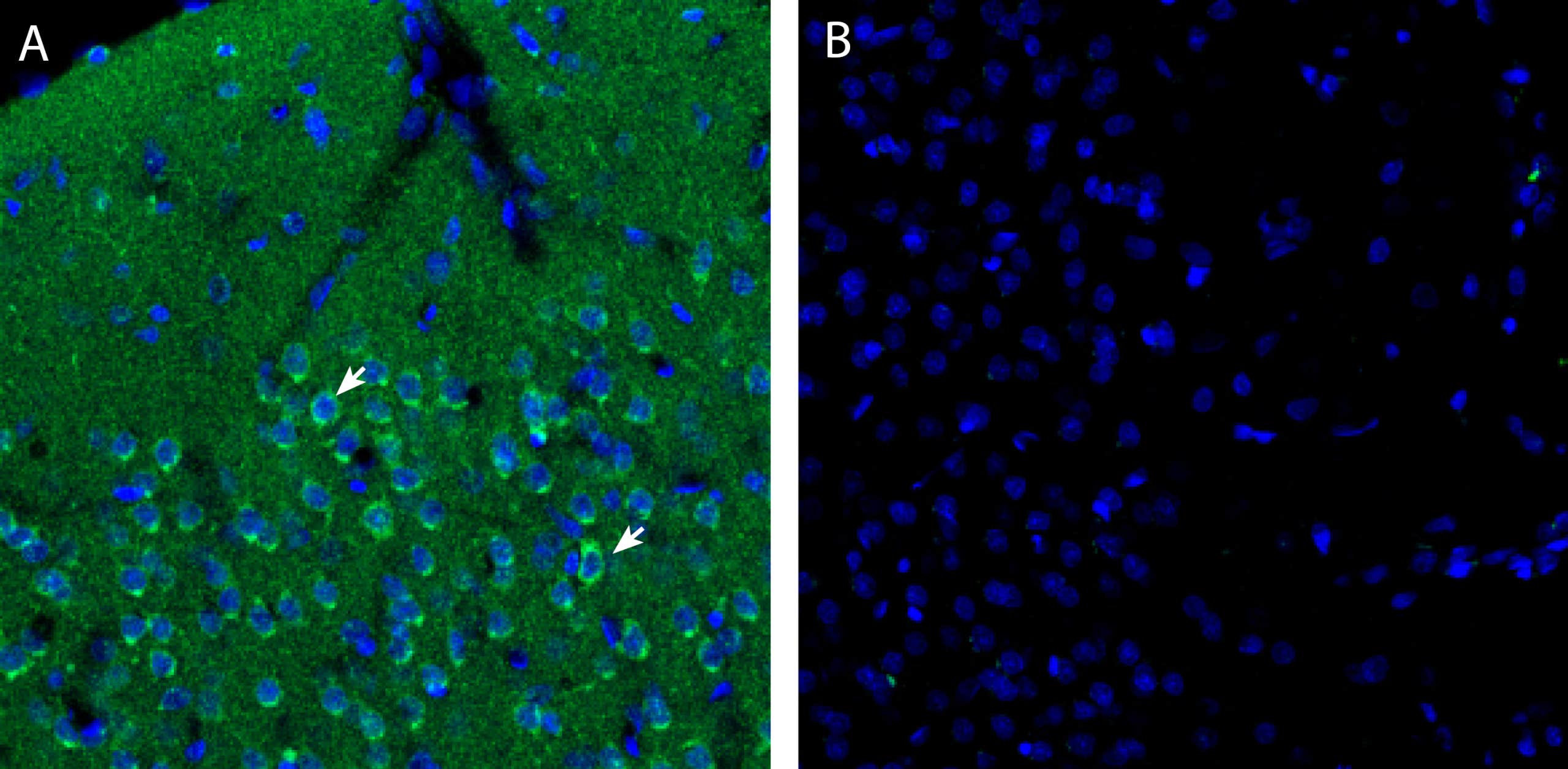 Anti-Endothelin Receptor A (extracellular) Antibody