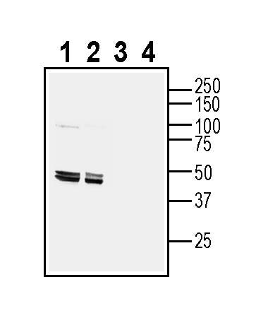 Endothelin Receptor A (extracellular) Blocking Peptide