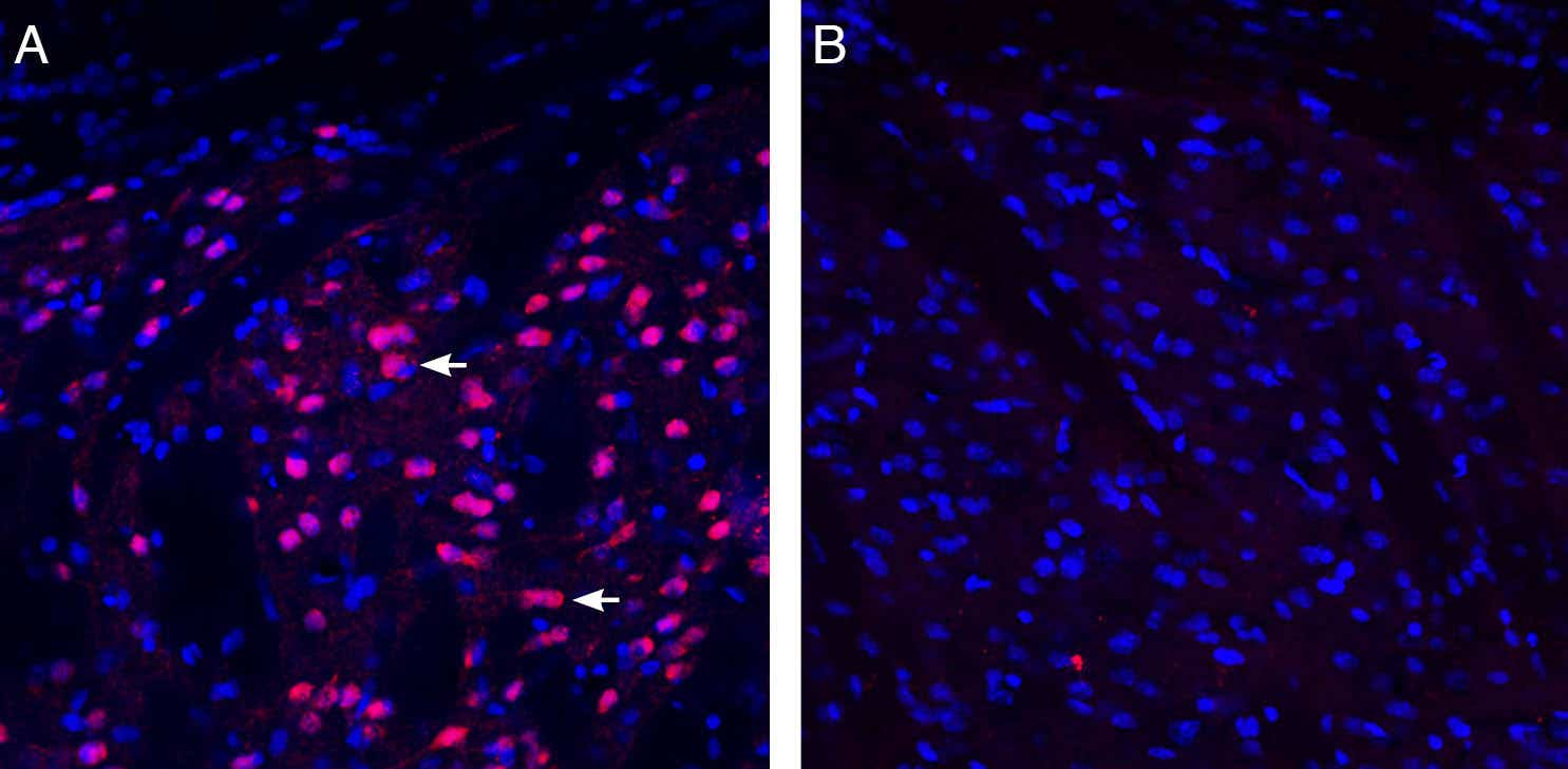 Anti-EphA1 (extracellular) Antibody