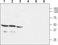 GPER/GPR30 Blocking Peptide