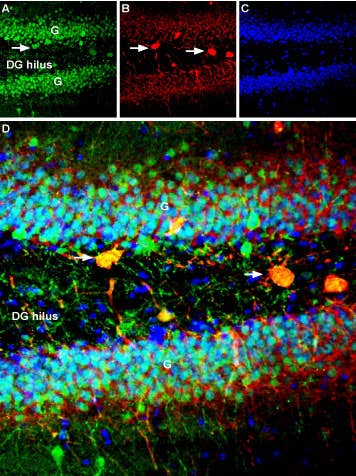 Anti-GPER (GPR30) Antibody
