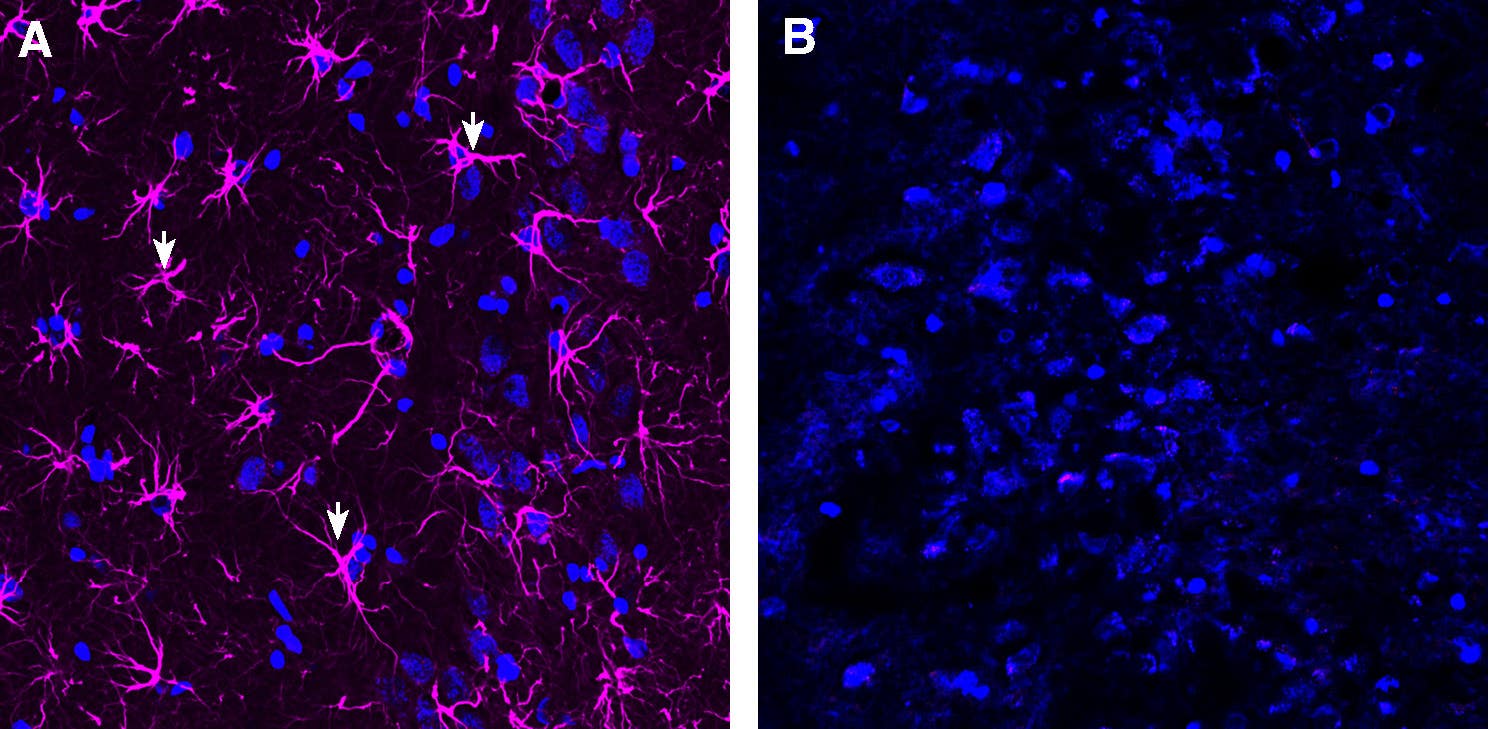Anti-GFAP-ATTO Fluor-647N Antibody