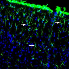Anti-GFAP Antibody
