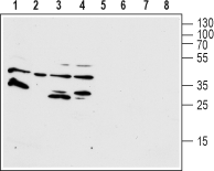 Human FPR1 (extracellular) Blocking Peptide