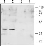 Human FPR2/ALX (extracellular) Blocking Peptide