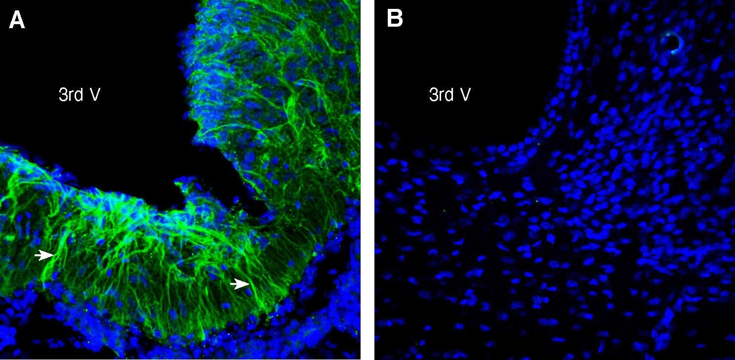 Anti-FSHR (extracellular) Antibody