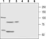 FSHR (extracellular) Blocking Peptide