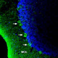 Anti-GPR40/FFAR1 (extracellular) Antibody