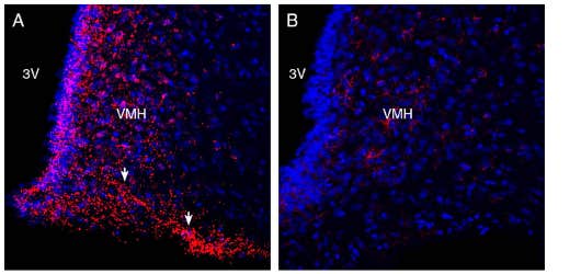 Anti-GPR120/FFAR4 (extracellular) Antibody