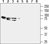 Human GPR43/FFAR2 (extracellular) Blocking Peptide