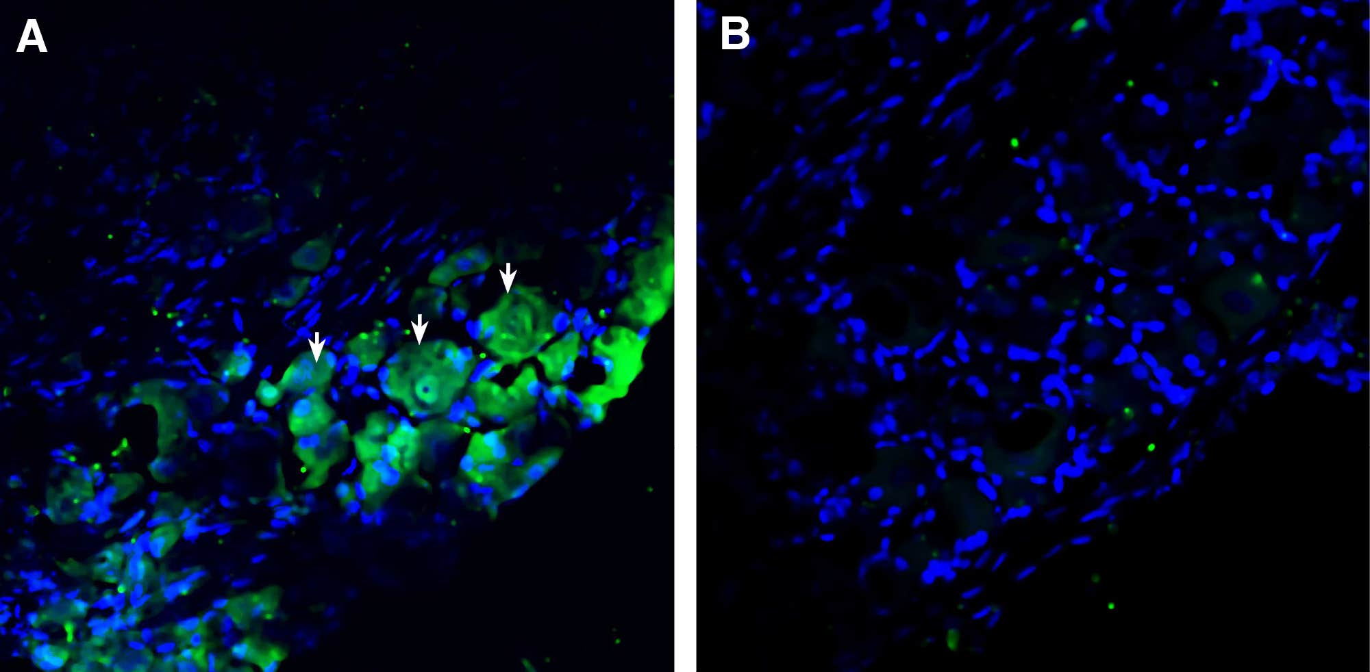Anti-GPR41/FFAR3 (extracellular) Antibody