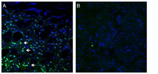 Anti-Frizzled-3 (FZD3) Antibody