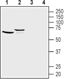 Frizzled-1/FZD1 (extracellular) Blocking Peptide
