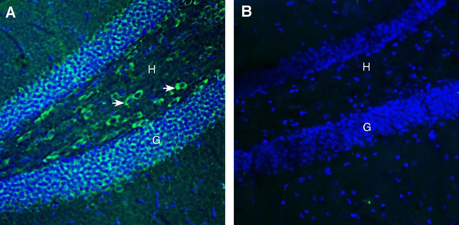 Anti-FLRT3 (extracellular) Antibody