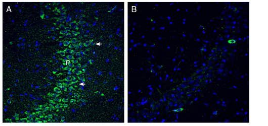 Anti-SLC19A1/RFC1 (extracellular) Antibody