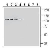 SLC19A1/RFC1 (extracellular) Blocking Peptide