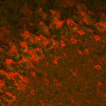 Anti-GABA(A) α2 Receptor Antibody