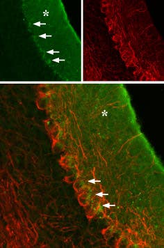 Anti-GABA(A) α3 Receptor (extracellular) Antibody