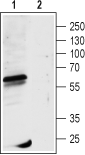Anti-GABA(A) ρ1 Receptor (GABRR1) (extracellular) Antibody