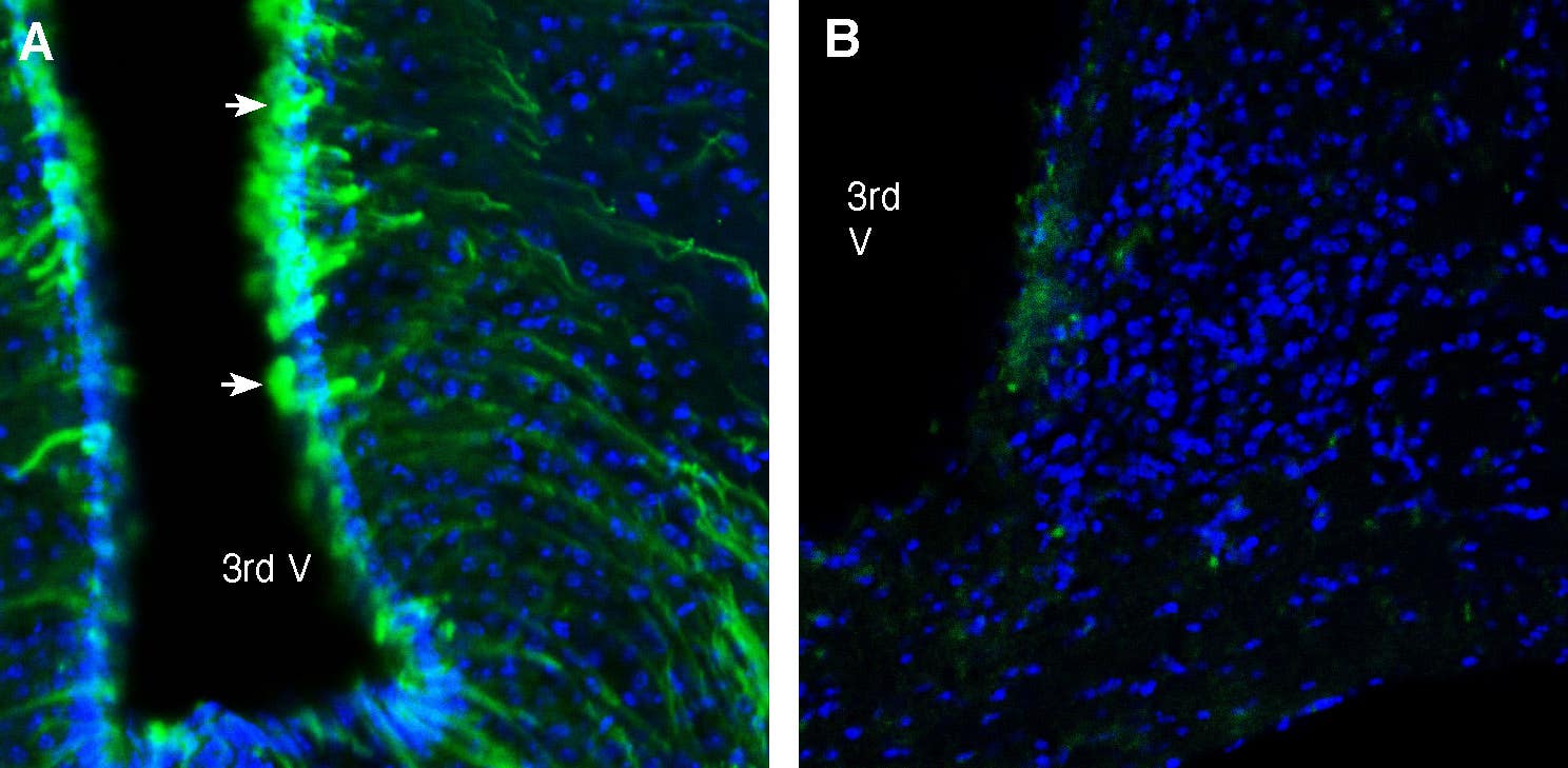 Anti-GABA(A) β2 Receptor Antibody