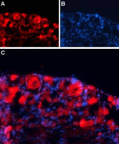 Anti-GABA(A) γ1 Receptor Antibody