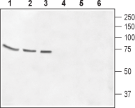 GABA(A) θ Receptor/GABRQ (extracellular) Blocking Peptide