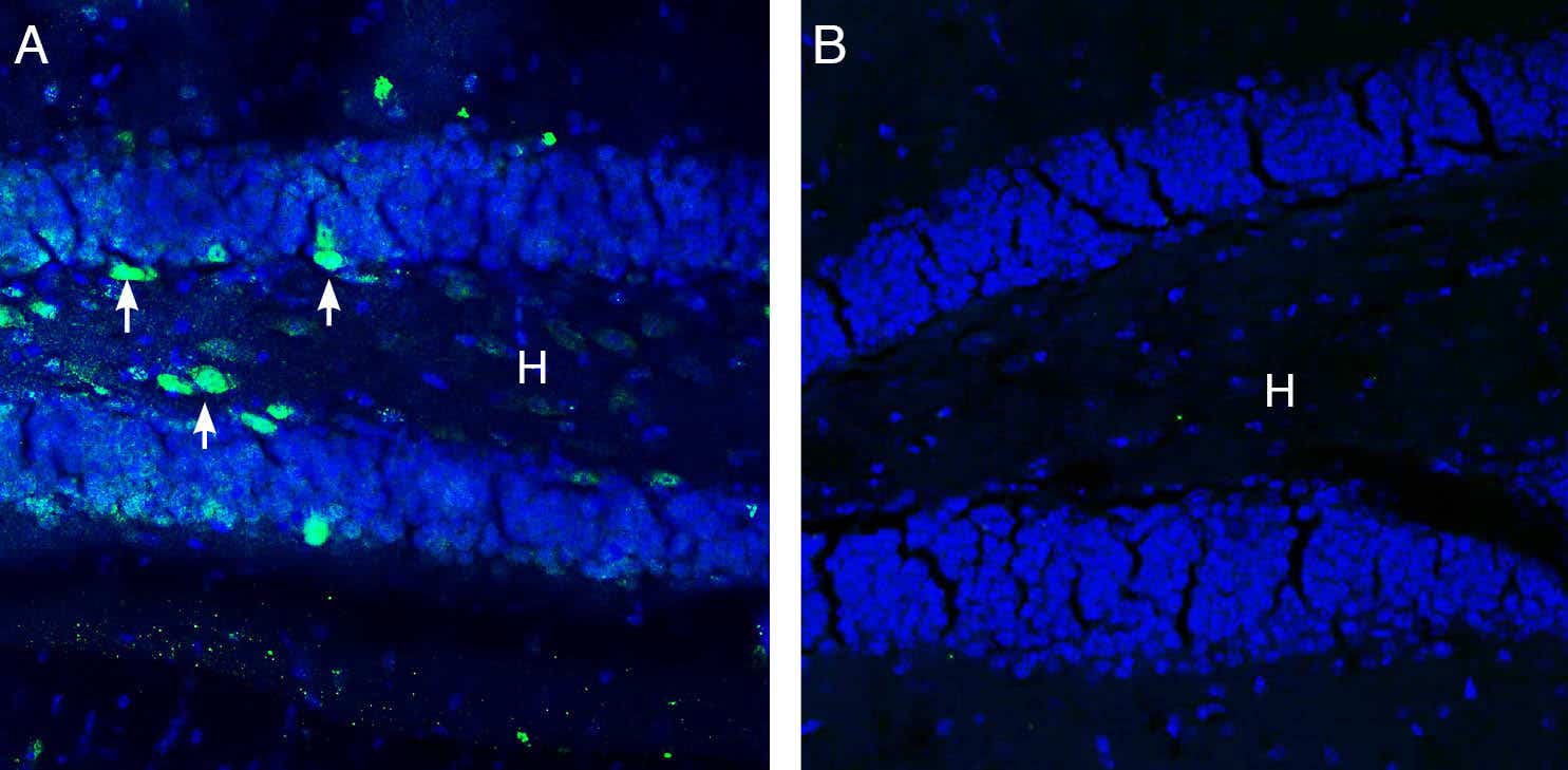 Anti-GABA(A) π Receptor (extracellular) Antibody