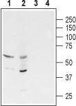 GABA(A) ρ3 Receptor/GABRR3 (extracellular) Blocking Peptide