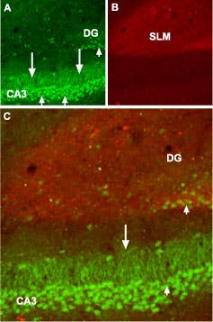 Anti-GABA(B) R1 (extracellular) Antibody