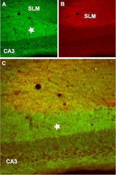 Anti-GABA(B) R2 Antibody
