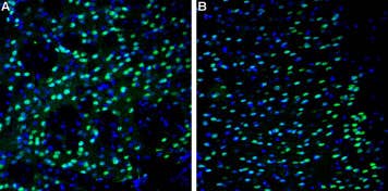 Anti-NMDAR2A (GluN2A) (extracellular)-ATTO Fluor-488 Antibody