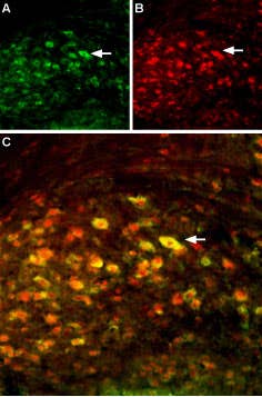 Anti-NMDAR2A (GluN2A) (extracellular) Antibody