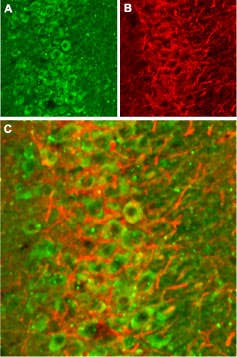 Anti-NMDAR2B (GluN2B) (extracellular) Antibody
