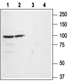 GluR1/GluA1 (extracellular) Blocking Peptide