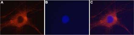 Anti-GRIK2 (GluK2) Antibody