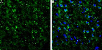 Anti-mGluR7 (extracellular) Antibody