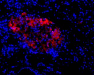 Anti-NMDAR2C (GRIN2C) (extracellular) Antibody