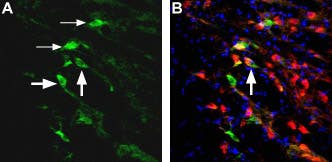 Anti-NMDAR2D (GRIN2D) (extracellular) Antibody