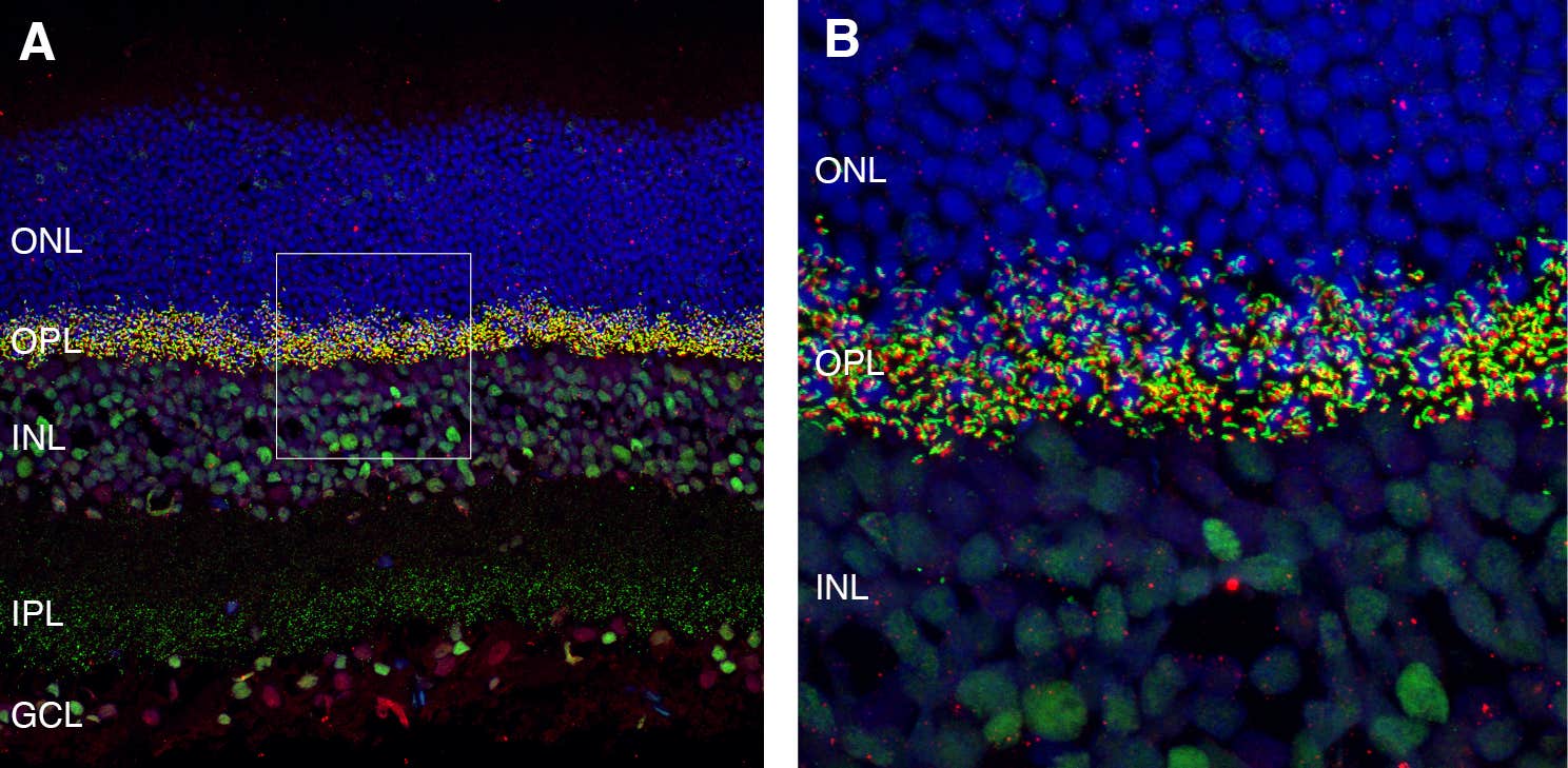 Anti-mGluR6 (extracellular) Antibody