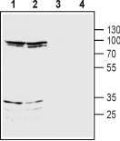 NMDAR3B/GRIN3B (extracellular) Blocking Peptide