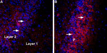 Anti-VGLUT3 Antibody