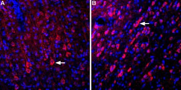 Anti-GRID1 (extracellular) Antibody