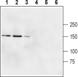 Anti-GRID2 (extracellular) Antibody