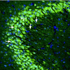 Anti-GRIK5 (GluK5) (extracellular) Antibody