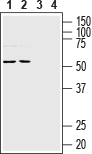 NETO1 (extracellular) Blocking Peptide
