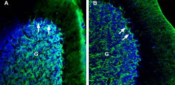 Anti-NETO2 (extracellular) Antibody