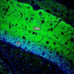 Anti-GSG1L Antibody