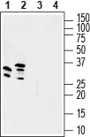 GSG1L Blocking Peptide