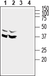Anti-SynDIG1 Antibody
